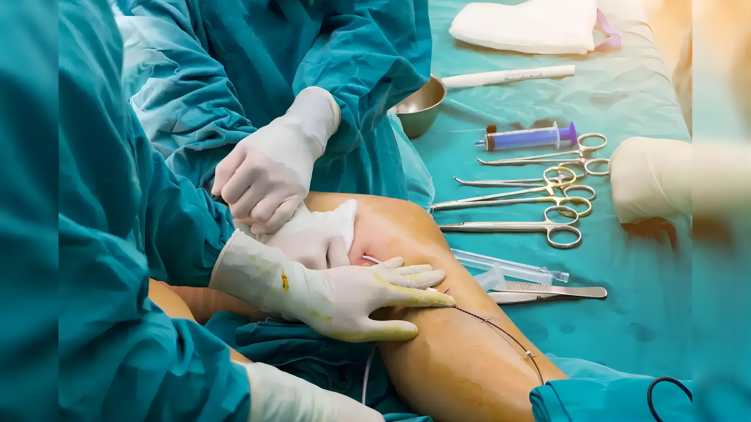 Système de perfusion intra-osseuse électrique