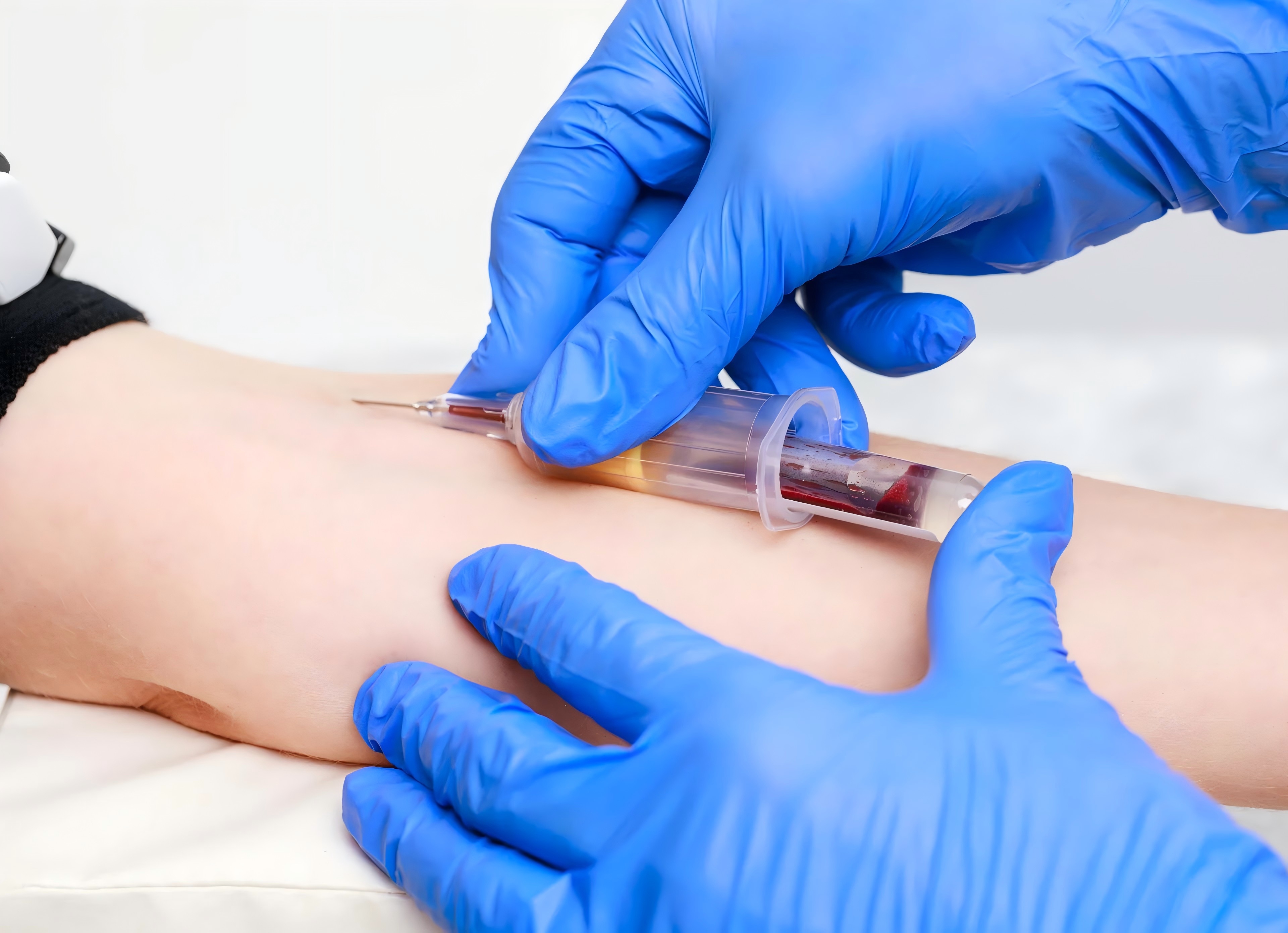 méthode-la-plus-courante-pour-prélèver-le-sang-veineux-en vedette