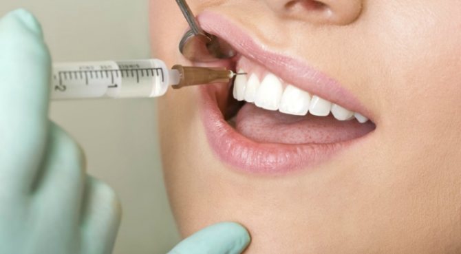 Injection dentaire