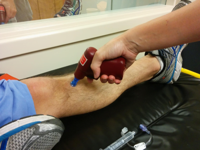 Système de perfusion intra-osseuse électrique