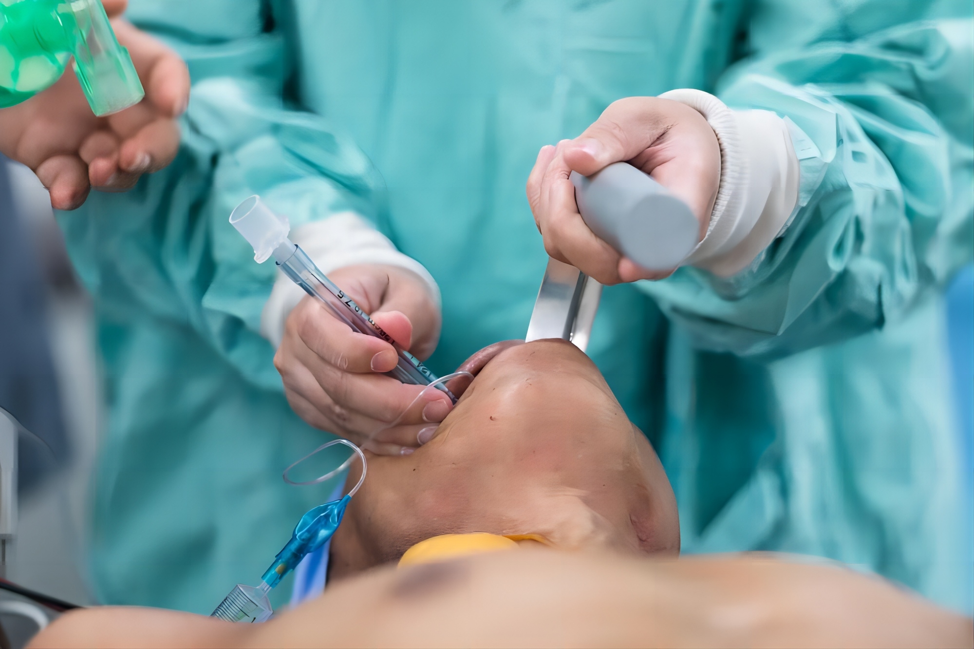 tube endotrachéal jetable
