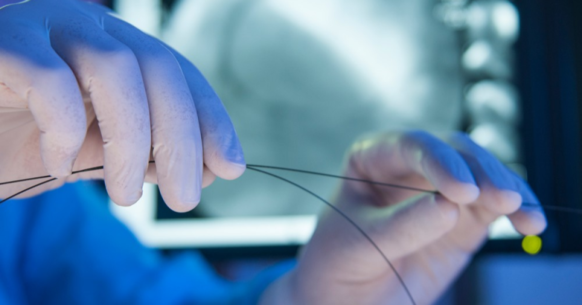 Chirurgie interventionnelle cardiovasculaire