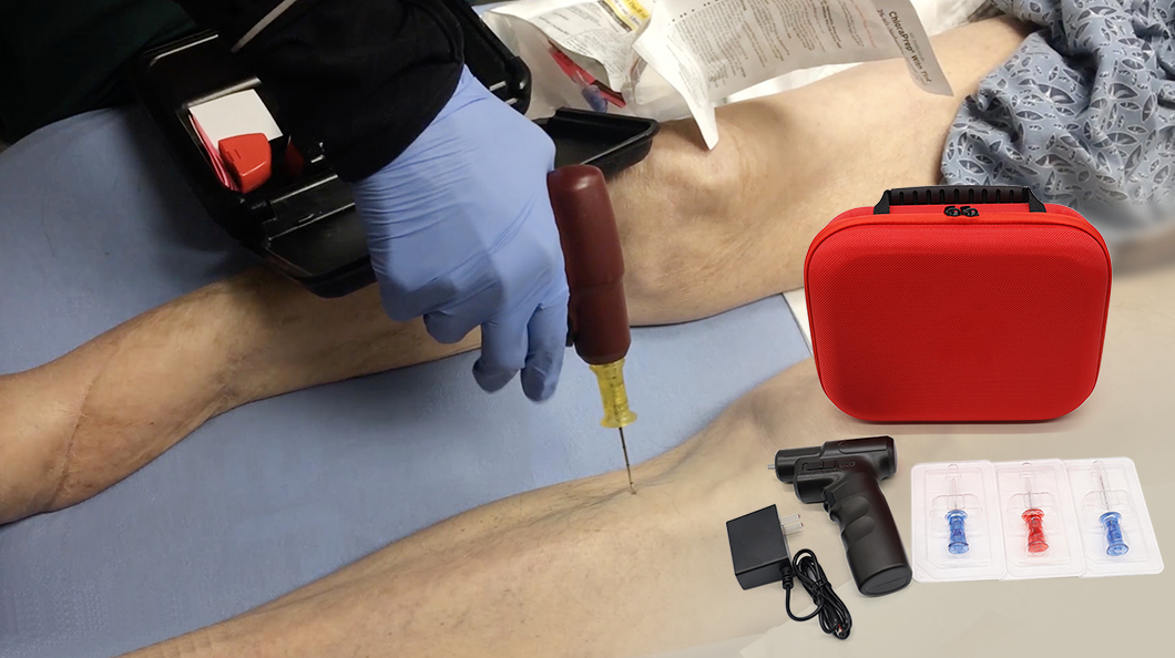 Système de perfusion intra-osseuse électrique
