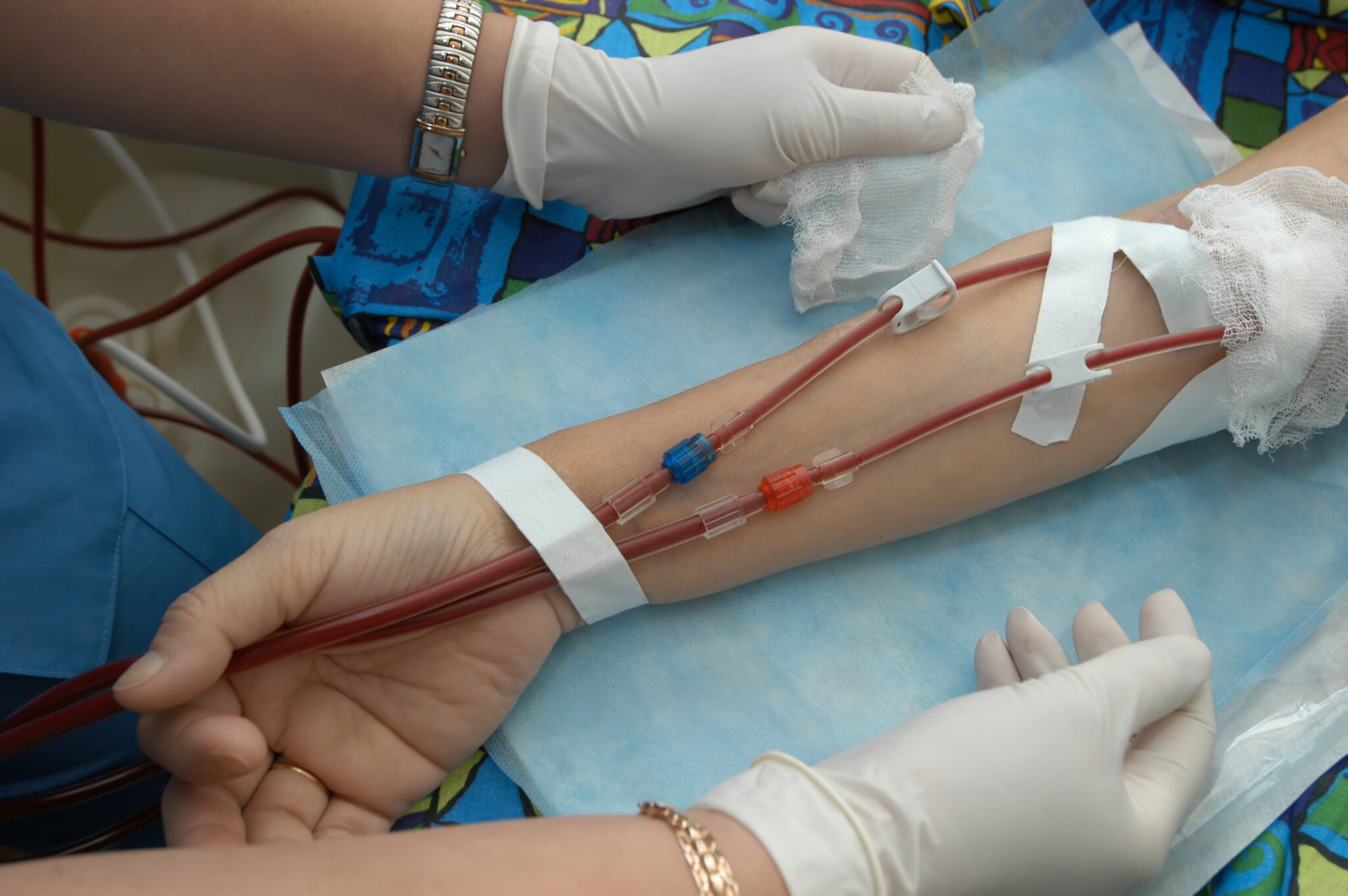 Dialyse