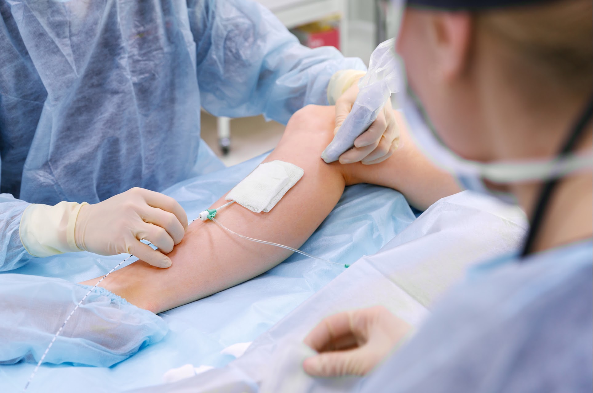 Décapage des varices