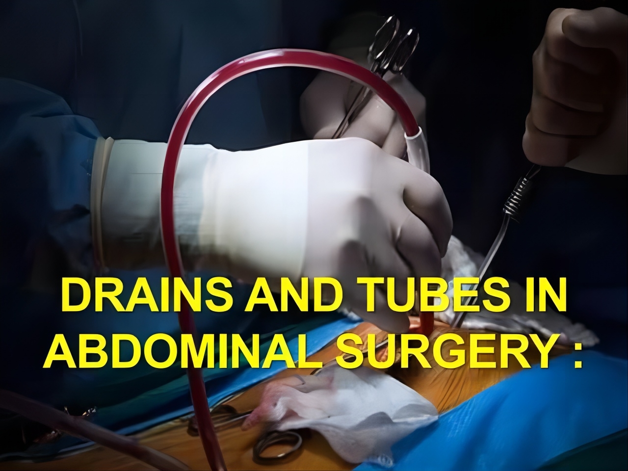 tube de drainage jetable