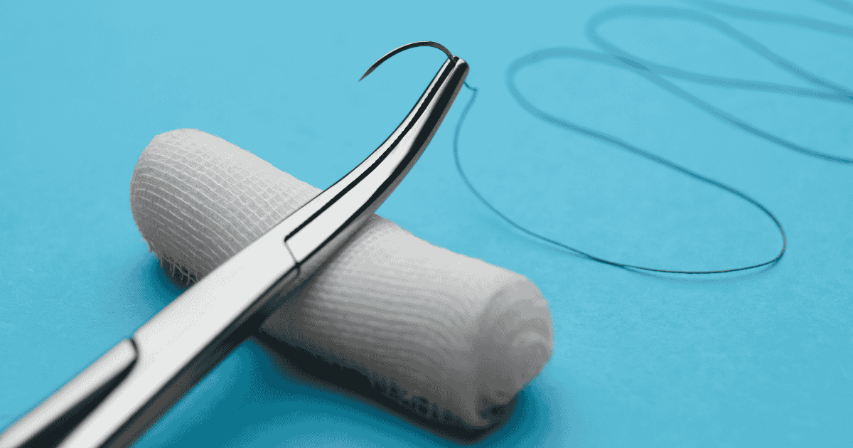 suture r&eacute;sorbable ou non r&eacute;sorbable1.png