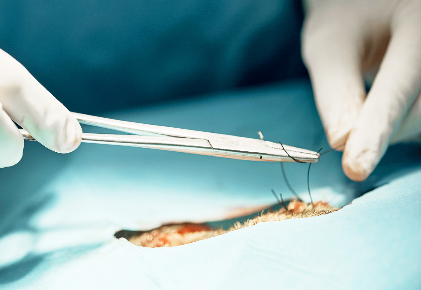 noeud chirurgical4.jpg