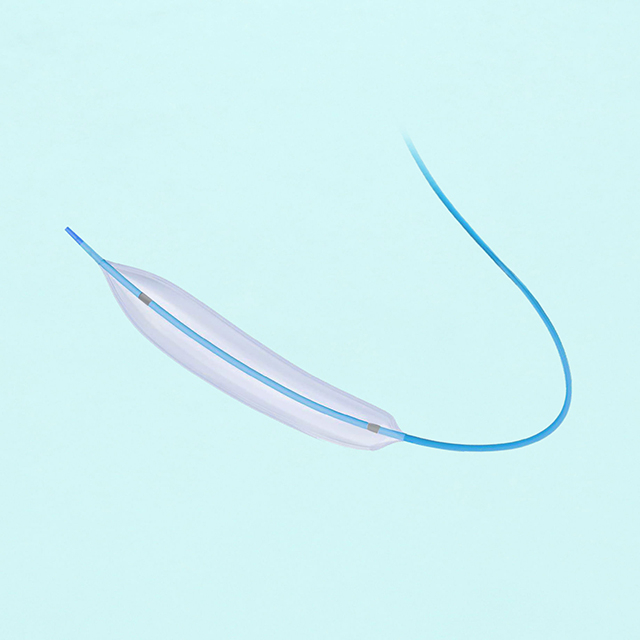 Cathéter de dilatation à ballonnet PTCA pour angioplastie coronarienne transluminale percutanée