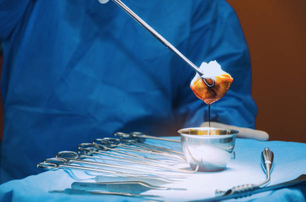 Tampons de gaze m&eacute;dicale