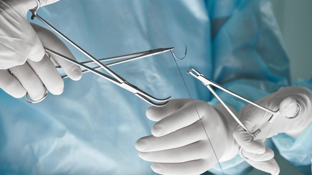 sutures vicryl2.jpg