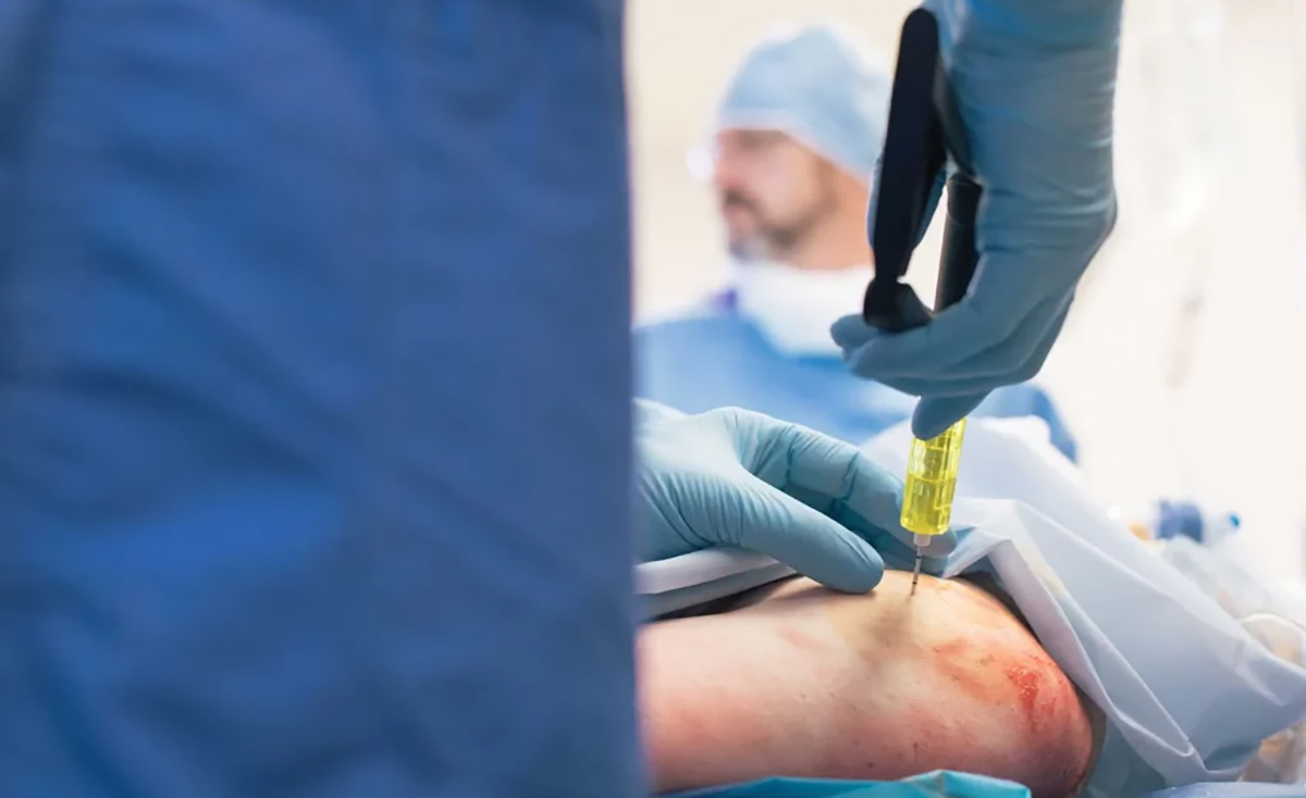 Complications d'acc&egrave;s intra-osseux3
