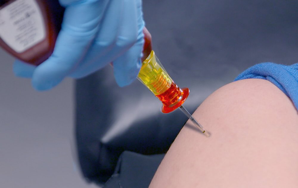 perfusion intra-osseuse3
