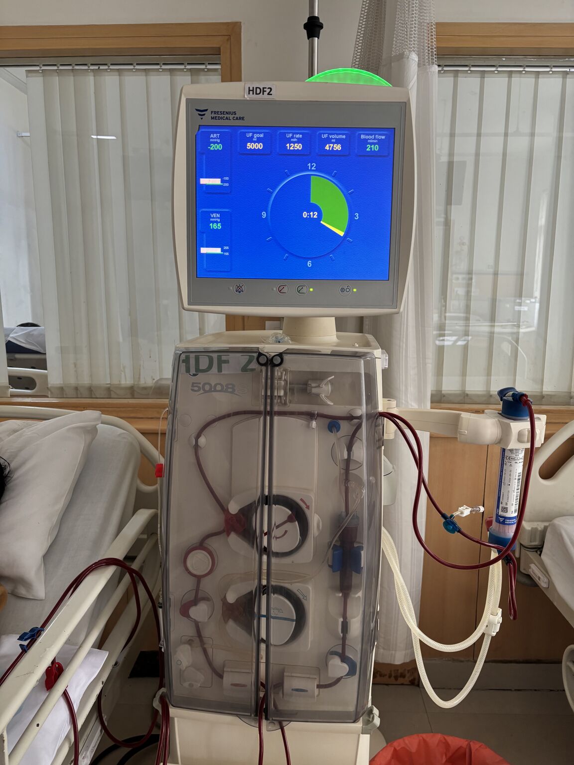 Lign&eacute;es d&eacute;di&eacute;es &agrave; l'appareil de dialyse Fresenius 5008
