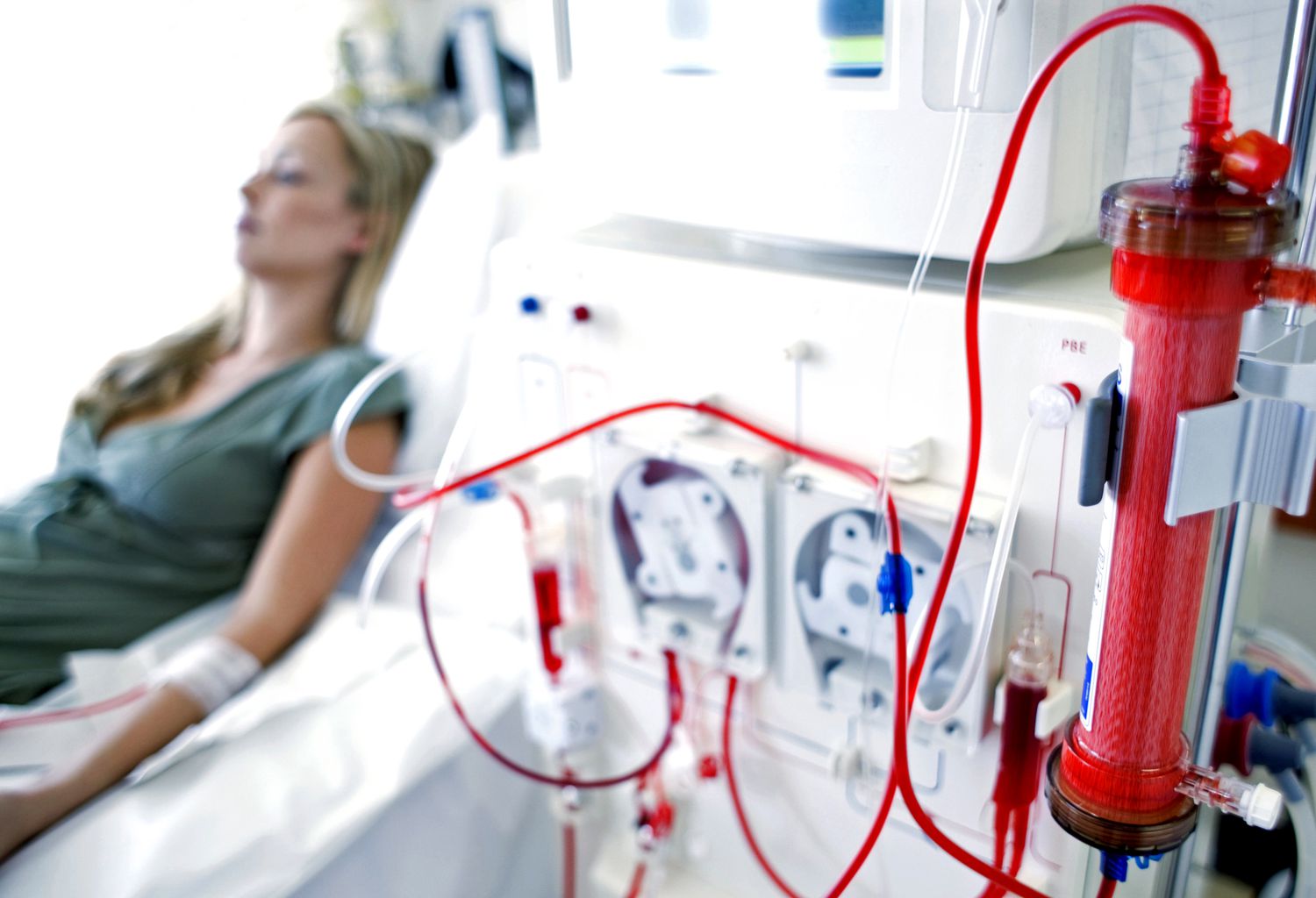 R&Eacute;NAL_DIALYSIS-56a275235f9b58b7d0cac1e2