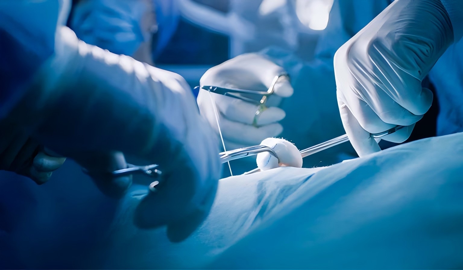 gros plan-sur-les-mains-du-chirurgien-professionnel-suture-plaie-apr&egrave;s-une-chirurgie-r&eacute;ussie