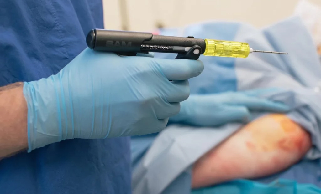 perfusion intra-osseuse2