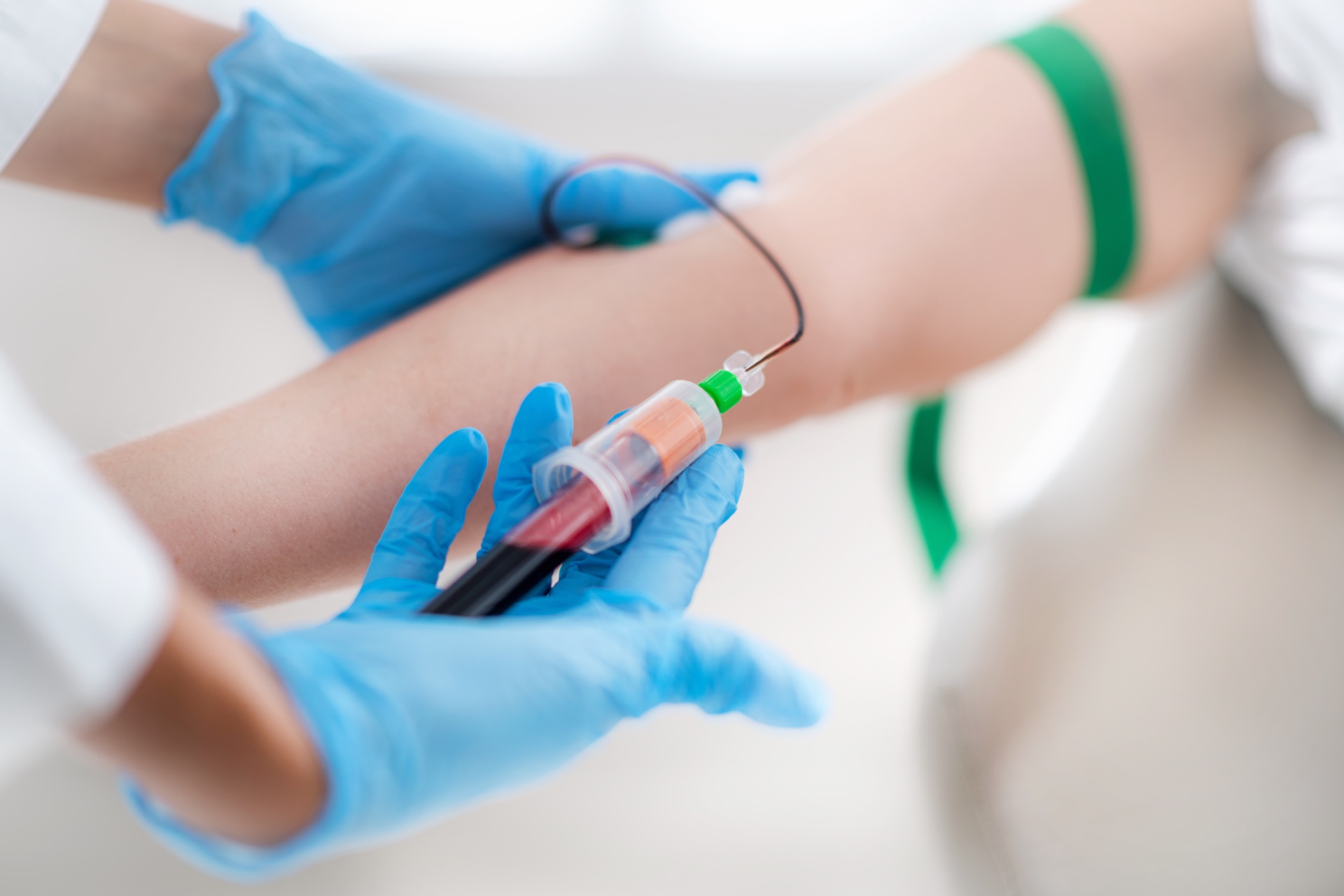 LAB &amp;IVD Consumables