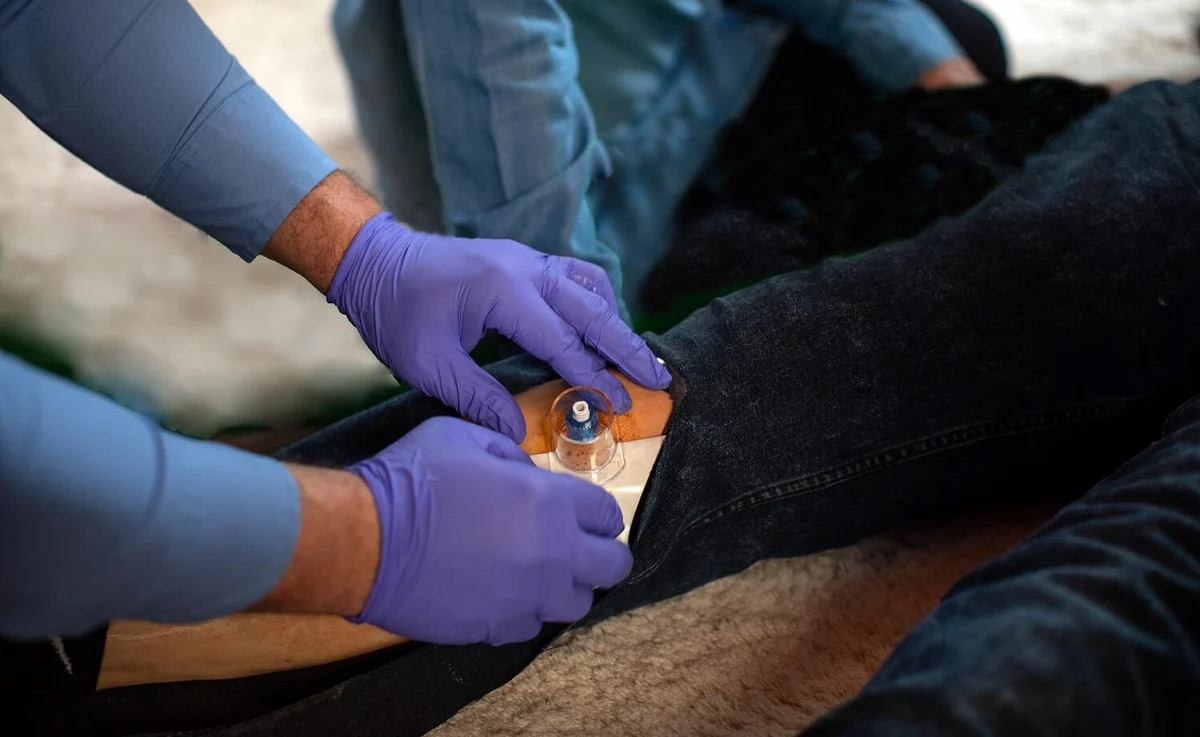 perfusion intra-osseuse1.jpg