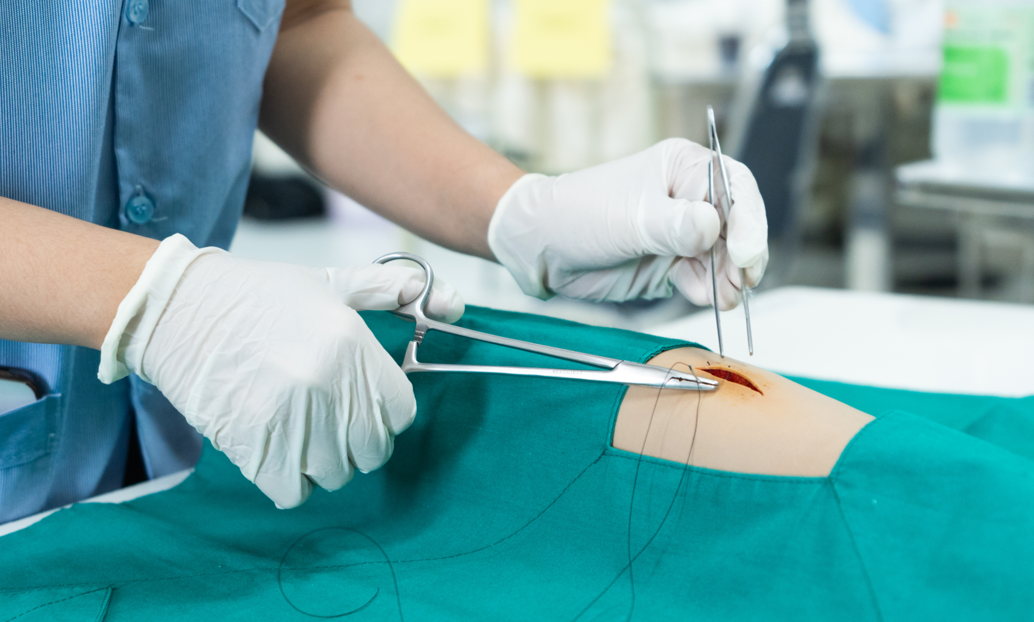 r&eacute;action de suture1.png