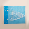 Kits obstétricaux jetables chirurgicaux Kit de livraison jetable personnalisé avec drap de naissance chirurgical