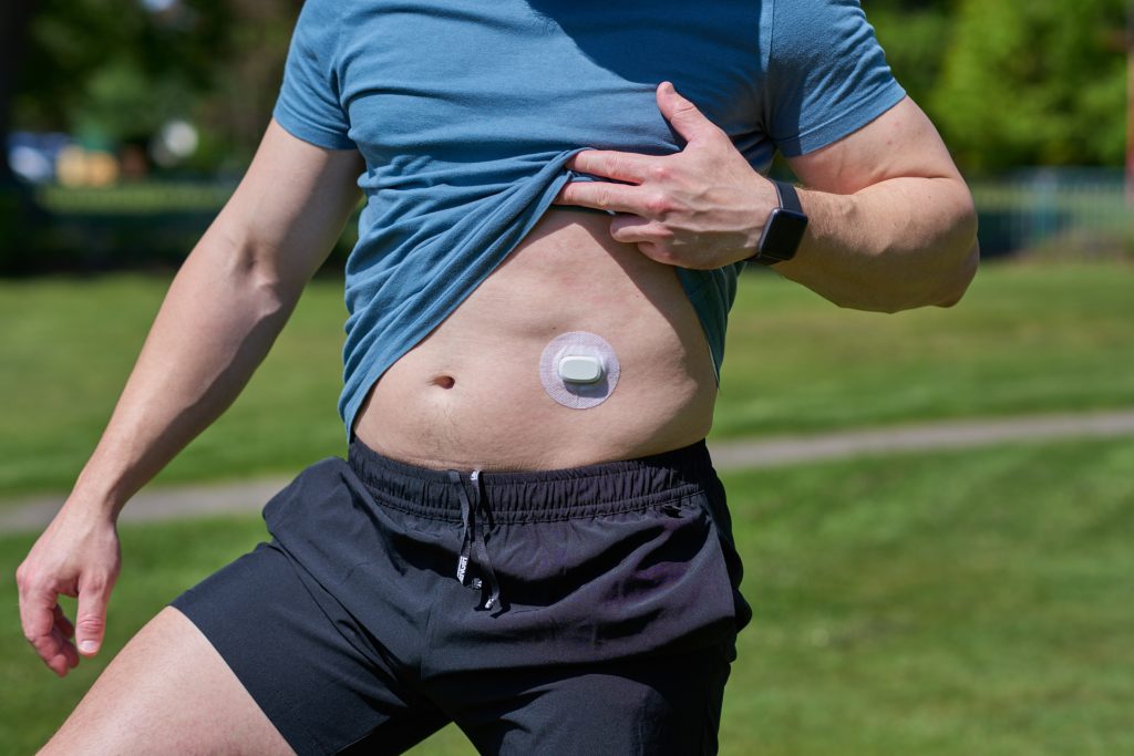 Syst&egrave;me de surveillance continue du glucose