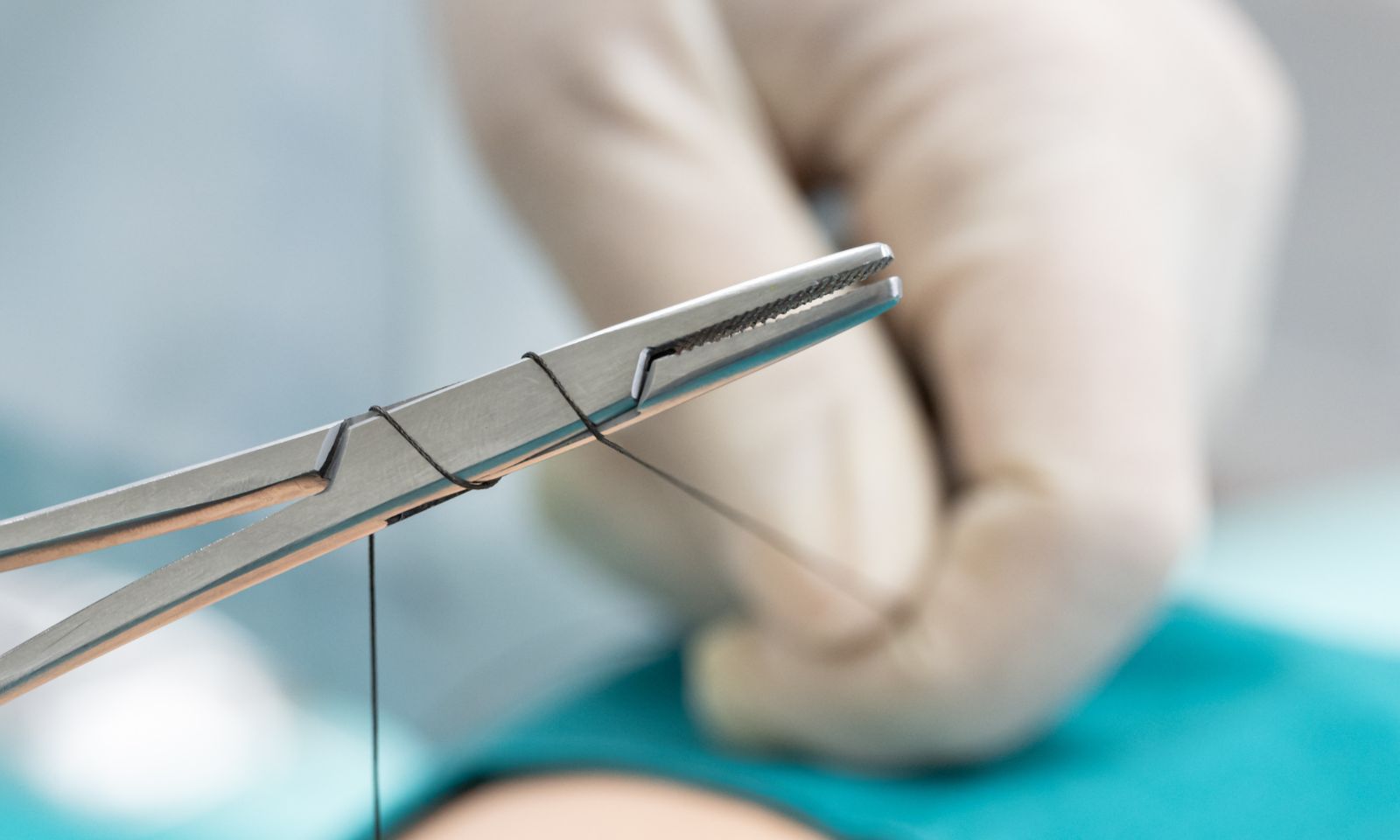 tailles de suture1.jpg