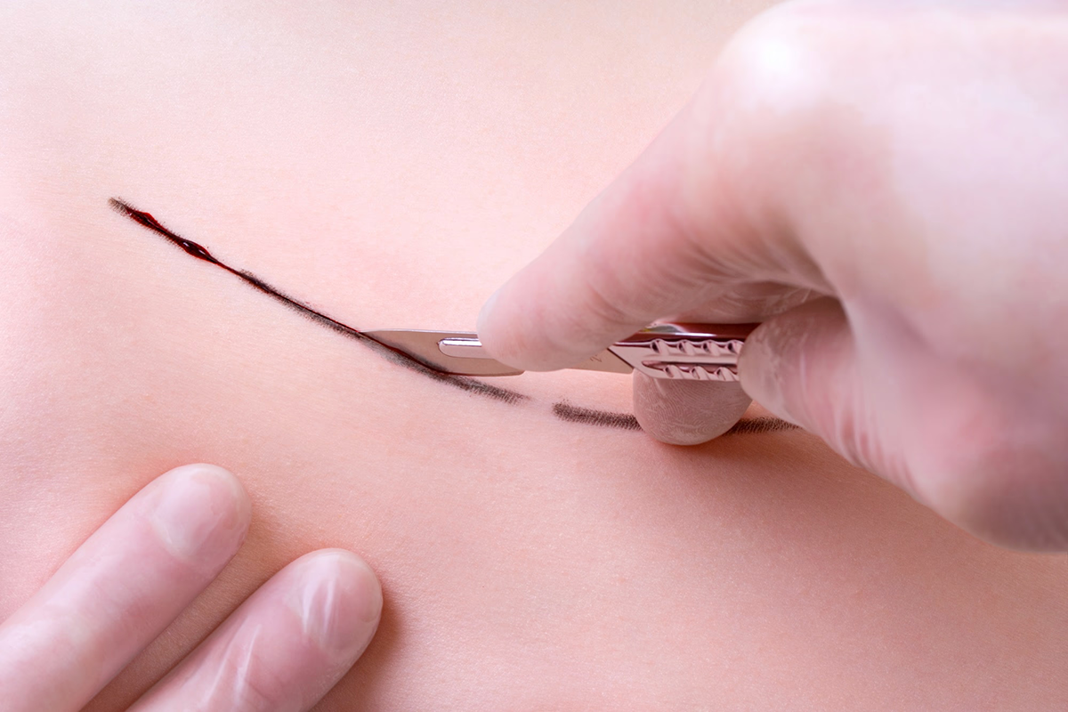 scalpel chirurgical2.png