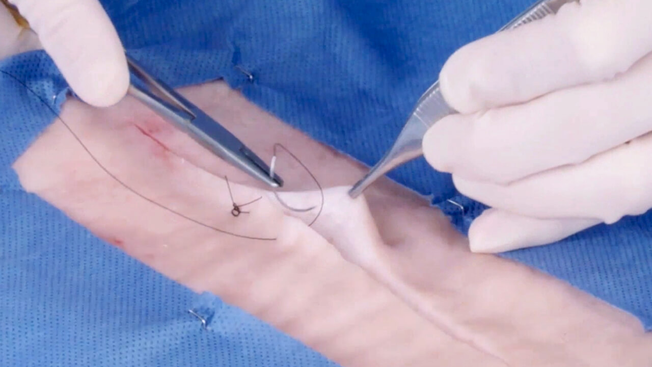 sutures vicryl3.jpg
